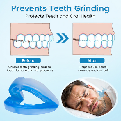 LAST DAY SALE 60% OFF⏰PerfectSleep Solution & Anti-Grinding Teeth Protector